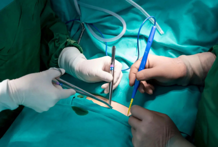 surgery consultation