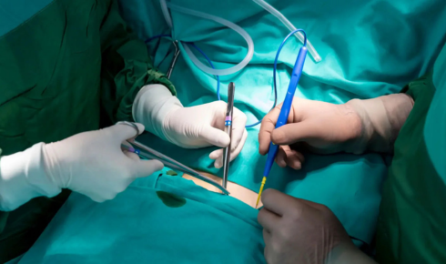 surgery consultation